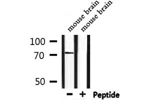 Western blot analysis of extracts from mouse  brain, using SLC6A8 Antibody. (SLC6A8 antibody  (C-Term))