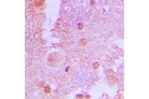 Immunohistochemical analysis of AS160 (pT642) staining in human brain formalin fixed paraffin embedded tissue section. (TBC1D4 antibody  (pSer642))