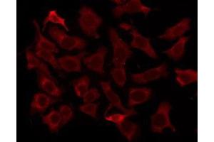 ABIN6276267 staining HeLa by IF/ICC. (OR5M1/5M10 antibody)