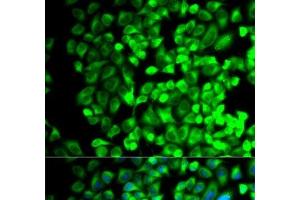 Immunofluorescence analysis of HeLa cells using TBXAS1 Polyclonal Antibody