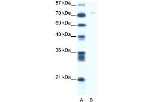 WB Suggested Anti-ASPH Antibody Titration:  5.