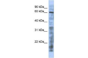 WB Suggested Anti-HTATIP Antibody Titration:  0. (KAT5 antibody  (N-Term))