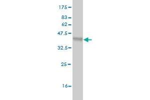 Western Blot detection against Immunogen (36. (DKK1 antibody  (AA 81-180))