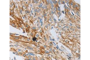 Immunohistochemistry (IHC) image for anti-Neurotrophin 3 (NTF3) antibody (ABIN3017532) (Neurotrophin 3 antibody)