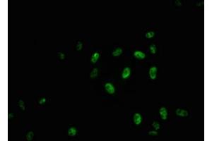 Immunofluorescence staining of Hela cells with ABIN7127716 at 1:100,counter-stained with DAPI. (Recombinant MYB antibody  (pSer11))