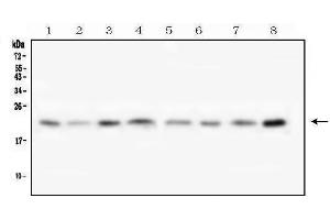 anti-Transmembrane Protein 199 (TMEM199) (AA 20-129) antibody