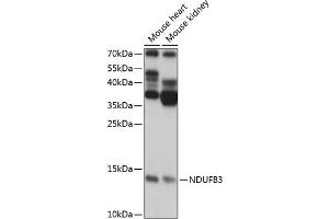 Western blot analysis of extracts of various cell lines, using NDUFB3 antibody (ABIN7268810) at 1:1000 dilution. (NDUFB3 antibody  (AA 1-98))