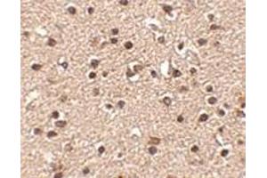 Immunohistochemistry of Dact2 in human brain tissue with Dact2 antibody at 2. (DACT2 antibody  (N-Term))