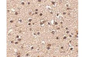 Immunohistochemistry of Dact2 in human brain tissue with Dact2 antibody at 2.