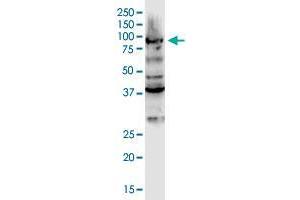 DCLK3 monoclonal antibody (M01), clone 2B1. (DCLK3 antibody  (AA 175-284))