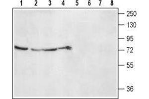 Western blot analysis of rat kidney (lanes 1 and 5), lung (lanes 2 and 6), liver (lanes 3 and 7) lysates and rat skeletal muscle membranes (lanes 4 and 8): - 1-4. (ADRA2B antibody  (2nd Extracellular Loop, Cys169))