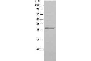 Western Blotting (WB) image for Carbonic Anhydrase VII (CA7) (AA 1-264) protein (His tag) (ABIN7286148) (CA7 Protein (AA 1-264) (His tag))