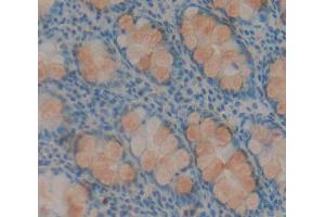IHC-P analysis of rectum tissue, with DAB staining. (HABP2 antibody  (AA 24-560))