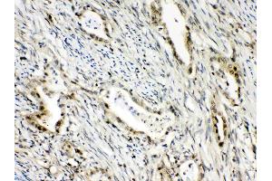 Immunohistochemistry (IHC) image for anti-RAN Binding Protein 1 (RANBP1) (AA 2-201) antibody (ABIN5518868)