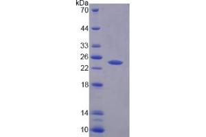 SDS-PAGE (SDS) image for Protein tyrosine Phosphatase, Receptor Type, N Polypeptide 2 (PTPRN2) (AA 839-1015) protein (His tag) (ABIN6239396)