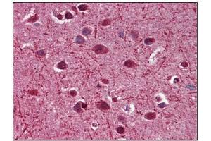 Immunohistochemistry (IHC) image for anti-Myelin Associated Glycoprotein (MAG) (AA 119-209) antibody (ABIN782426) (MAG antibody  (AA 119-209))