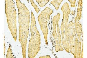 IHC analysis of Desmin using anti-Desmin antibody (ABIN7599249).