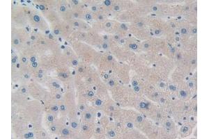 Detection of PPM1A in Human Liver Tissue using Polyclonal Antibody to Protein Phosphatase, Mg2+/Mn2+ Dependent 1A (PPM1A) (PPM1A antibody  (AA 2-382))
