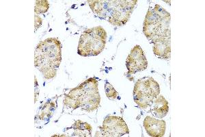 Immunohistochemistry of paraffin-embedded human gastric using STK3 antibody at dilution of 1:100 (x40 lens). (STK3 antibody)