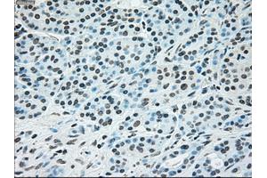 Immunohistochemical staining of paraffin-embedded Ovary tissue using anti-BRAFmouse monoclonal antibody.