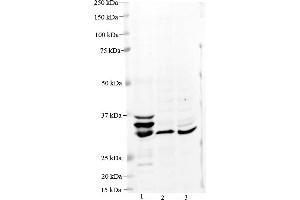 Host:  Rabbit  Target Name:  MPST  Sample Type:   Lane 1: 40 ug Human Liver lysate Lane 2: 40 ug Mouse Liver lysate Lane 3: 40 ug Rat Liver lysate  Primary Antibody Dilution:   1:1000  Secondary Antibody:    Anti-rabbit secondary antibody conjugated with Alexa Fluor 647  Secondary Antibody Dilution:   1:2500  Submitted by:   Hua Jiang, University of Colorado. (MPST antibody  (Middle Region))