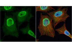 ICC/IF Image PGAM2 antibody detects PGAM2 protein at cytoplasm and nucleus by immunofluorescent analysis. (PGAM2 antibody)
