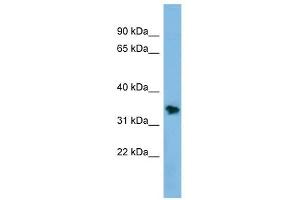 NSMCE1 antibody used at 1 ug/ml to detect target protein. (NSMCE1 antibody)