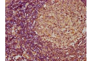 IHC image of ABIN7156913 diluted at 1:300 and staining in paraffin-embedded human lymph node tissue performed on a Leica BondTM system. (IL-4 antibody  (AA 25-153))