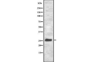 Western blot analysis NET-5 using HeLa whole cell lysates (Tetraspanin 9 antibody  (Internal Region))