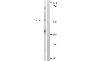 Western blot analysis of extracts from CV-1 cells treated with forsklin. (LKB1 antibody)