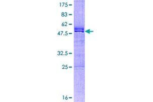 CXXC4 Protein (AA 1-198) (GST tag)