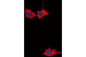Immunofluorescent analysis of GRB10 staining in HepG2 cells. (GRB10 antibody  (N-Term))