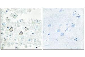 Immunohistochemistry analysis of paraffin-embedded human brain tissue using DOK7 antibody. (DOK7 antibody  (N-Term))