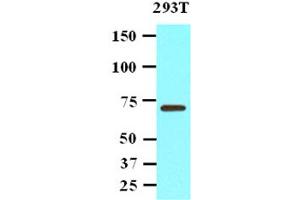 Western Blotting (WB) image for anti-Protein Phosphatase, Mg2+/Mn2+ Dependent, 1G (PPM1G) antibody (ABIN306467)