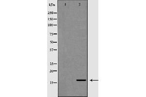 Western blot analysis of extracts of mouse heart, using POLR2D antibody. (POLR2D antibody  (N-Term))