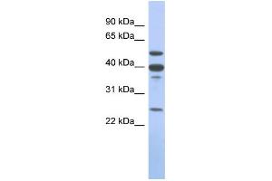 WB Suggested Anti-MMP13 Antibody Titration: 0. (MMP13 antibody  (Middle Region))