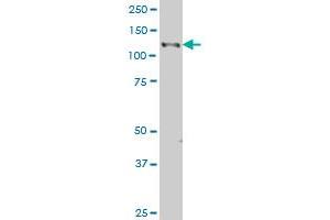 EPHB3 monoclonal antibody (M03), clone 2G9 Western Blot analysis of EPHB3 expression in HeLa .