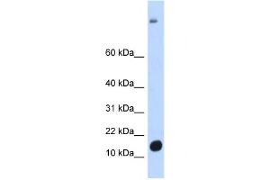 Western Blotting (WB) image for anti-Chromosome 6 Open Reading Frame 201 (C6orf201) antibody (ABIN2458562) (C6orf201 antibody)