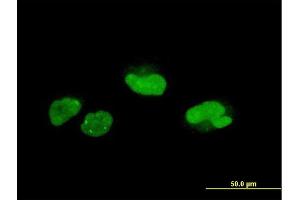 Immunofluorescence of monoclonal antibody to SCAND1 on HeLa cell. (SCAND1 antibody  (AA 1-179))