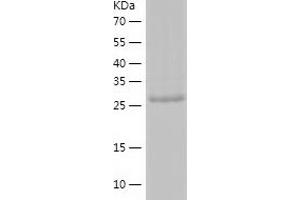 ASB8 Protein (AA 1-288) (His tag)
