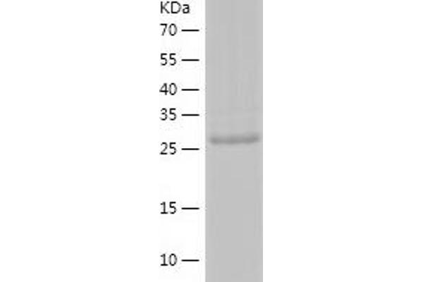 ASB8 Protein (AA 1-288) (His tag)