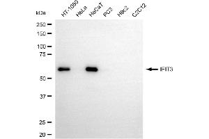 Western blotting analysis using IFIT3 antibody (ABIN7799090).