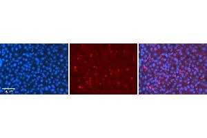Rabbit Anti-MLX Antibody   Formalin Fixed Paraffin Embedded Tissue: Human Liver Tissue Observed Staining: Cytoplasm in speckles in hepatocytes Primary Antibody Concentration: 1:100 Other Working Concentrations: 1:600 Secondary Antibody: Donkey anti-Rabbit-Cy3 Secondary Antibody Concentration: 1:200 Magnification: 20X Exposure Time: 0.