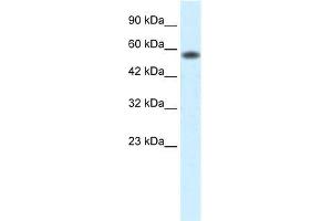 Human Jurkat; WB Suggested Anti-PCYOX1 Antibody Titration: 0.