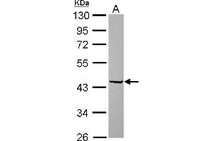 Western Blotting (WB) image for anti-Plasminogen Activator Inhibitor 2 (SERPINB2) (Center) antibody (ABIN2855574)