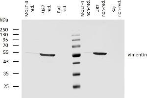 Western blotting analysis of human vimentin using mouse monoclonal antibody VI-10 on lysates of MOLT-4 cell line (low expression), U87 cell line (positive) and Raji cell line (negative control) under non-reducing and reducing conditions.