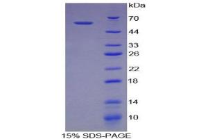 SDS-PAGE (SDS) image for Neuronal Pentraxin 1 (NPX1) (AA 115-364) protein (His tag,GST tag) (ABIN2123382)