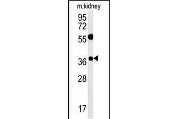 Tetraspanin 3 antibody  (AA 90-117)