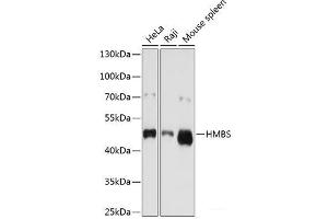 Western blot analysis of extracts of various cell lines using HMBS Polyclonal Antibody at dilution of 1:1000. (HMBS antibody)