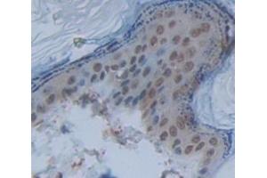Figure. (NFIX antibody  (AA 13-298))
